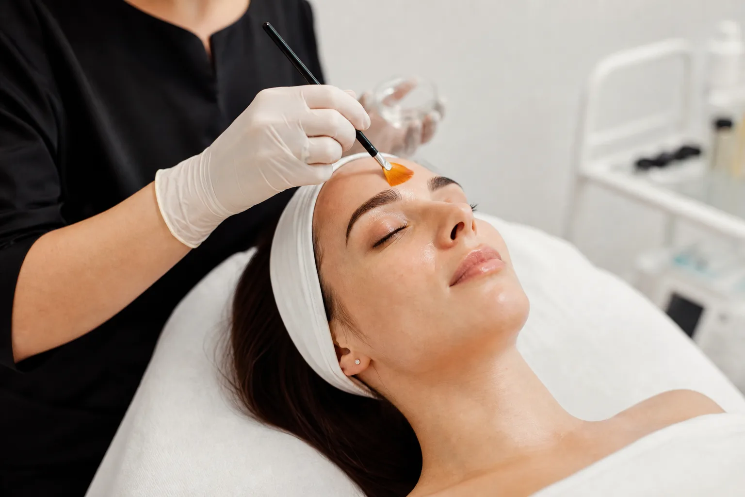 Chemical Peel intake preview